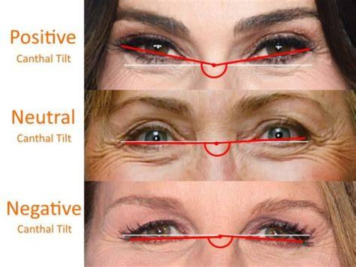 How to Use Canthal Tilt? - SarkariResult
